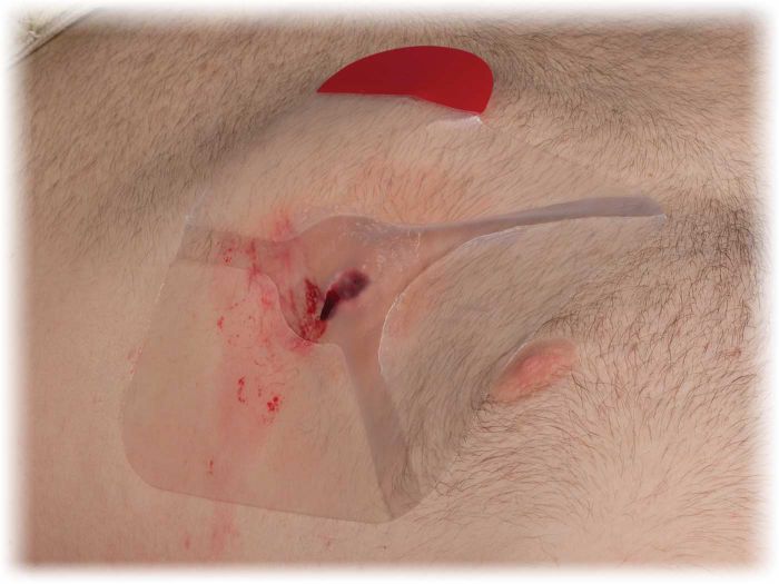 Hyfin Vent Chest Seal Twin Pack image 2