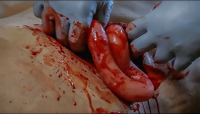 TOMManikin - BLAST image 4