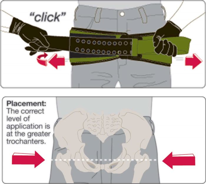 SAM Pelvic Sling image 1
